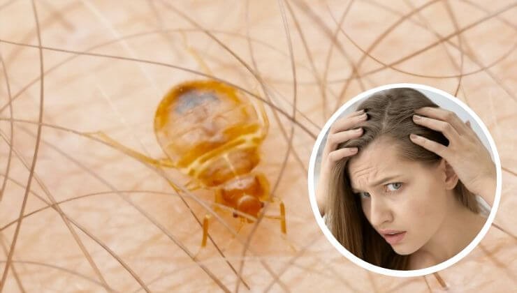 Bed bugs can get into your hair