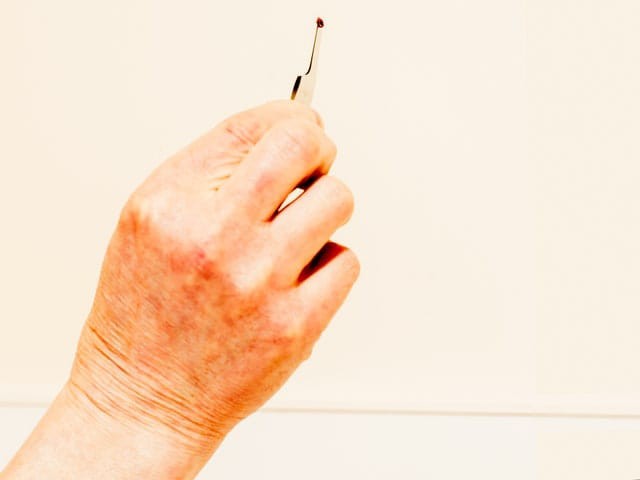 Bite marks on Regina Gries's arm 